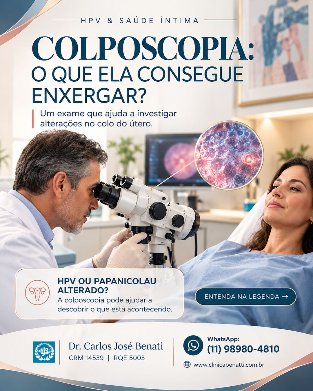 Exame de colposcopia para investigação de HPV ginecológico