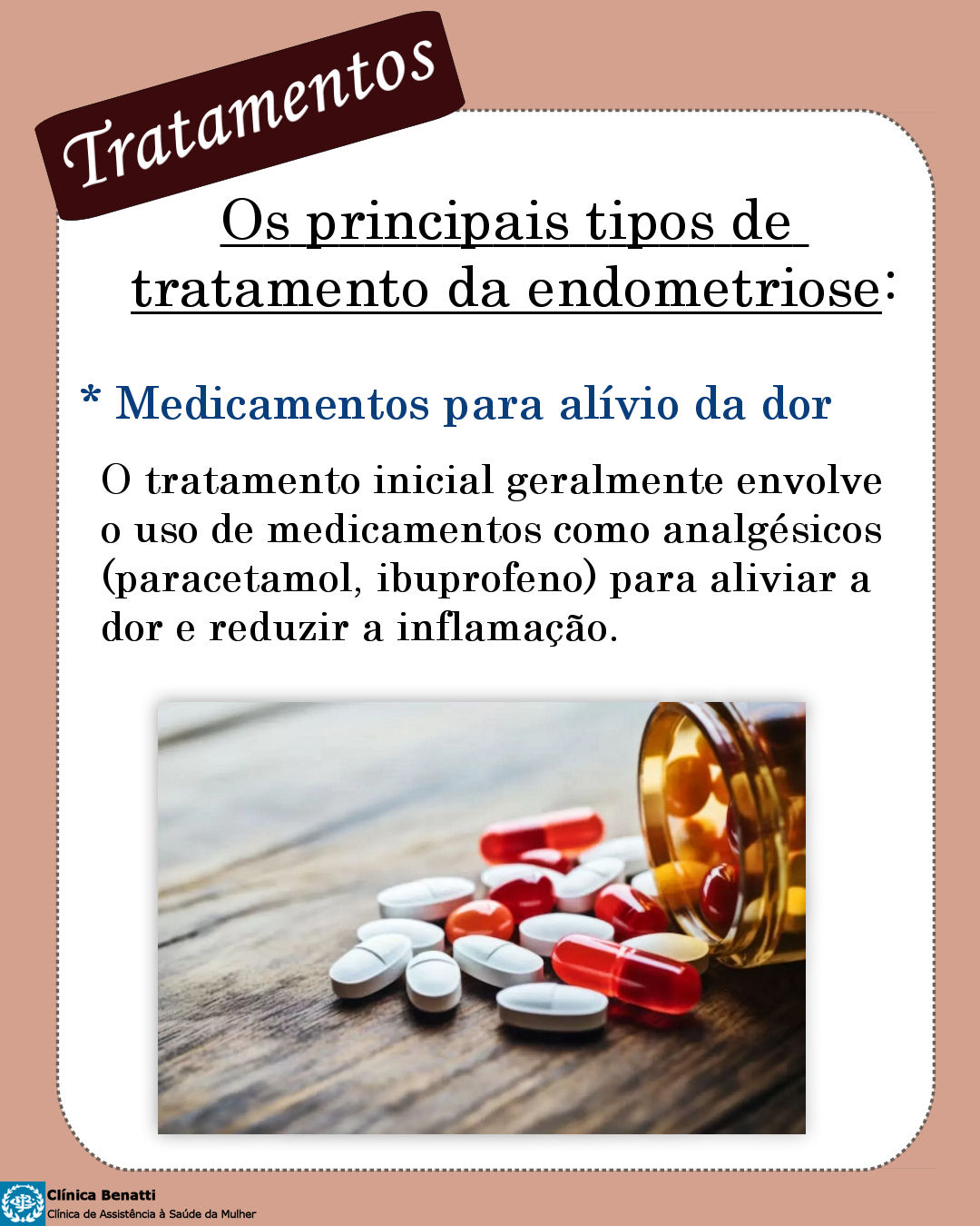 Principais Tratamentos para Endometriose