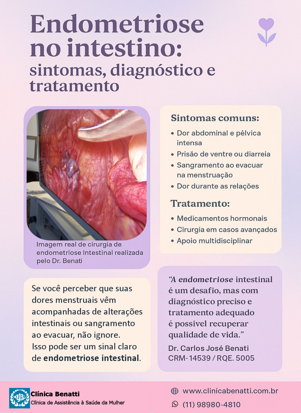 Endometriose no Intestino: um desafio silencioso para muitas mulheres