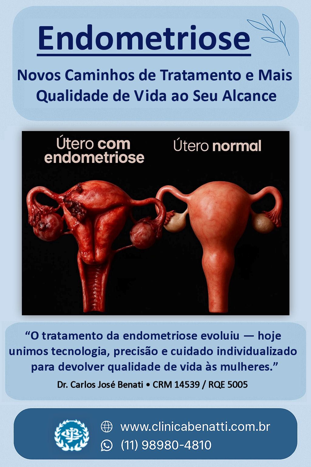 Alimentos que as Mulheres com Endometriose devem evitar