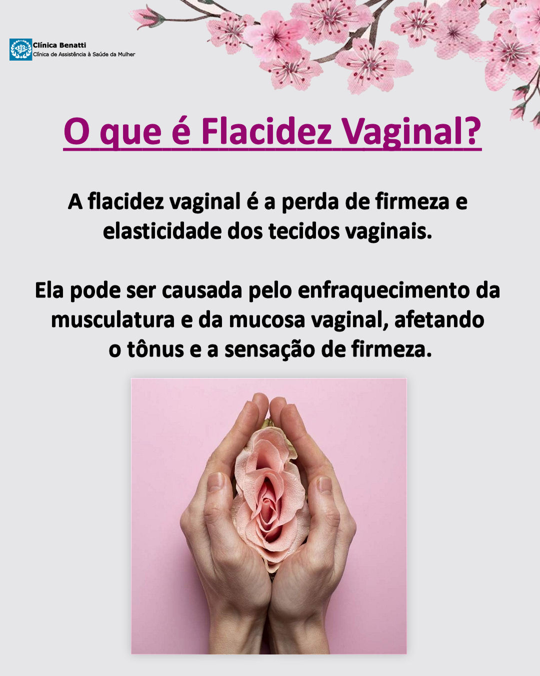 Flacidez Vaginal - Da Prevenção até o Tratamento