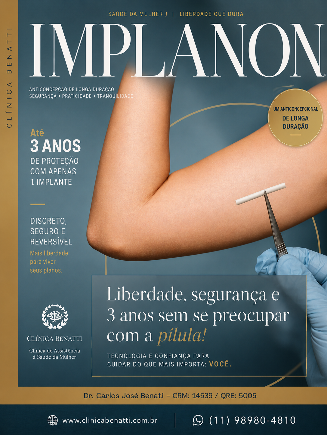 Implanon, implante contraceptivo hormonal de longa duração