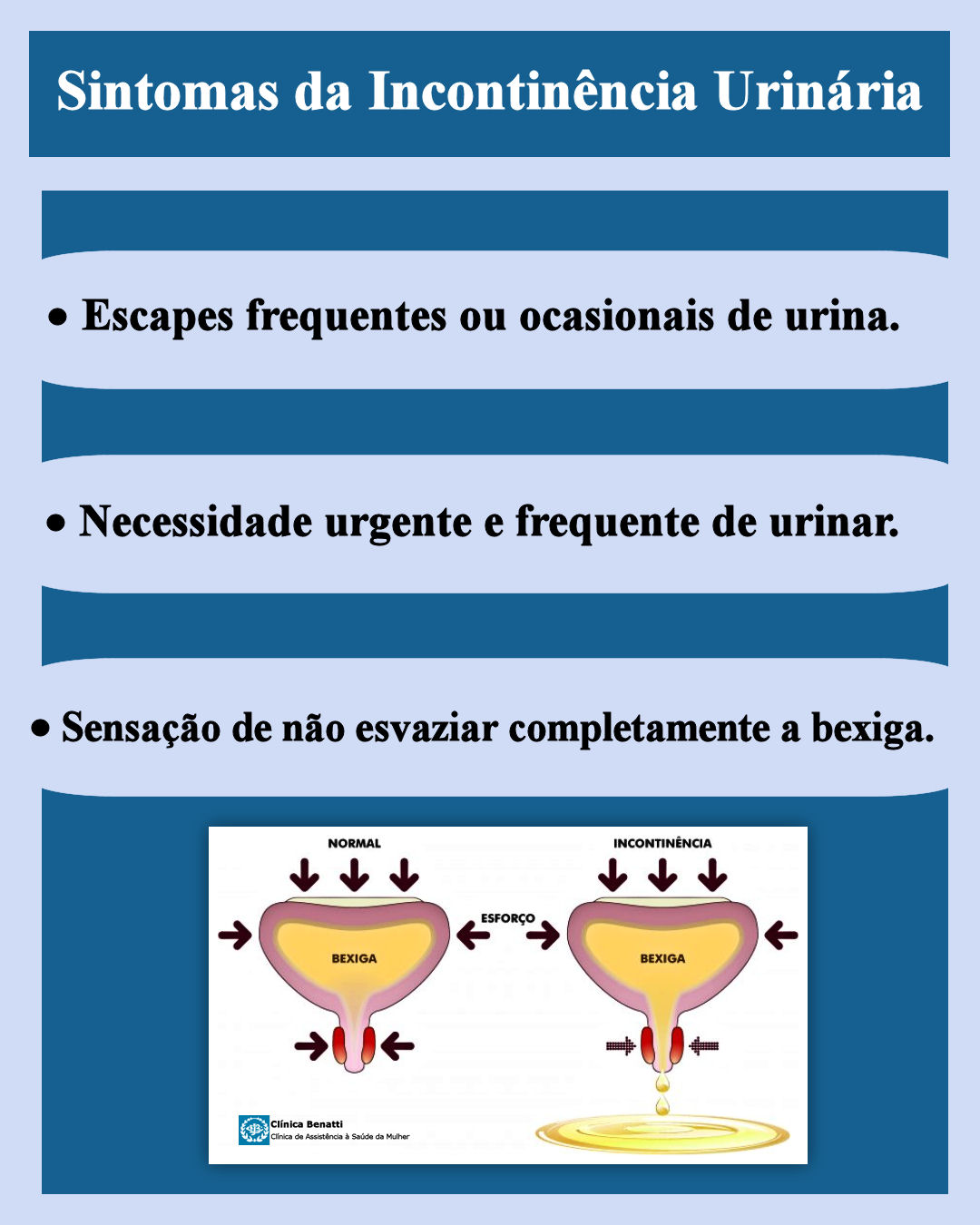 Tudo o que você precisa saber sobre Incontinência Urinária