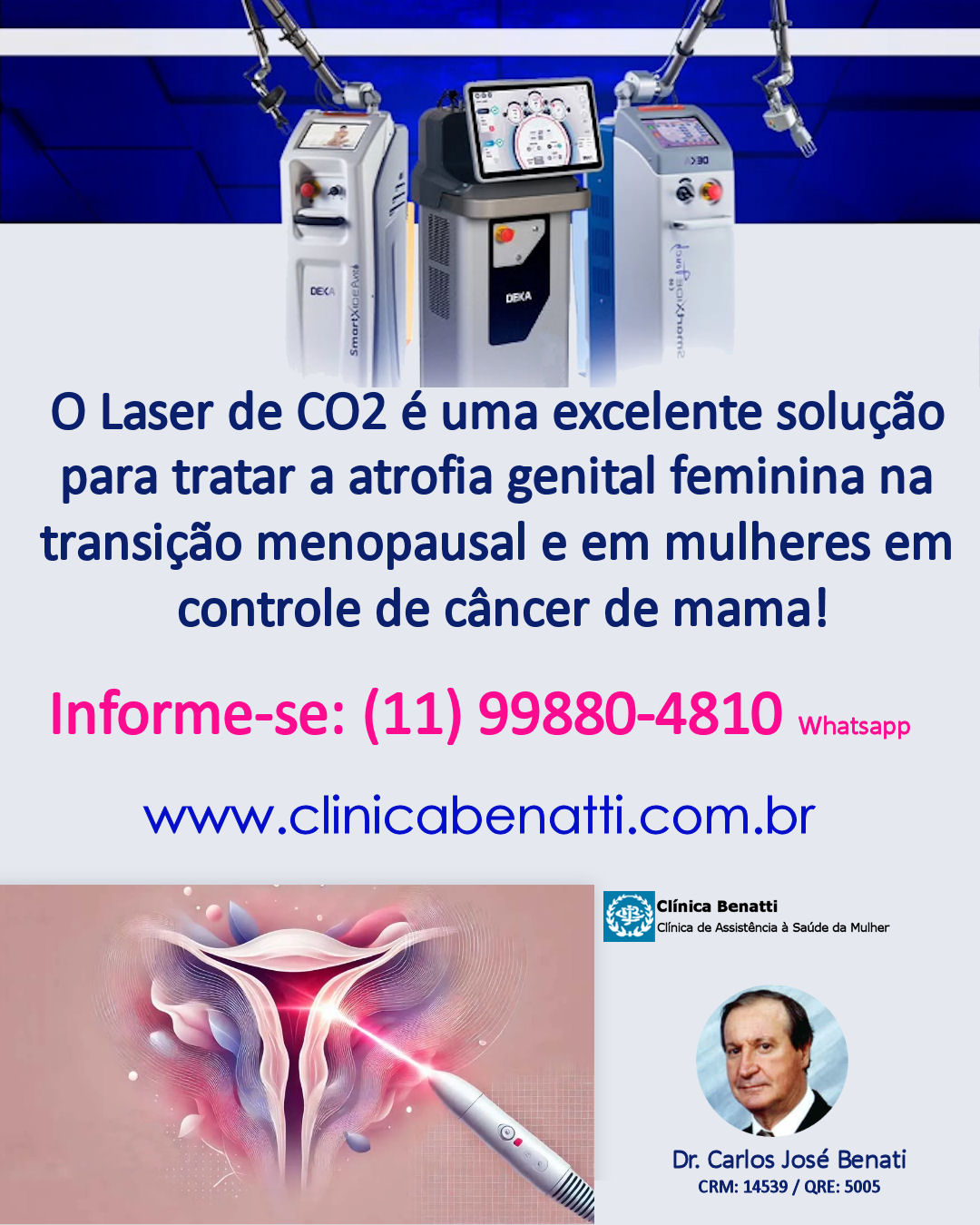 O Laser de CO2 é uma solução eficaz para a Atrofia Genital Feminina