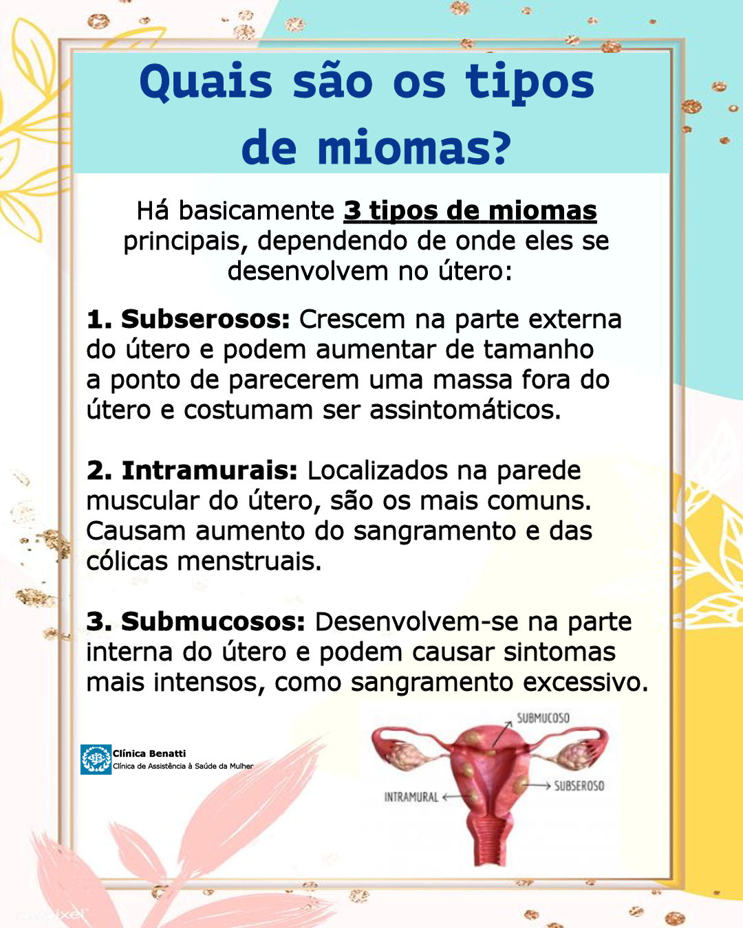Quais os tipos de miomas?