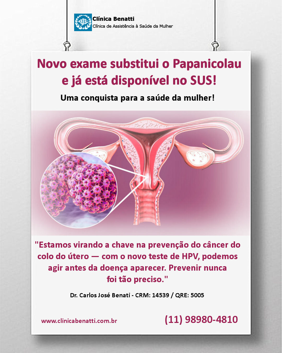 Novo exame substitui o Papanicolau e já está disponível no SUS!