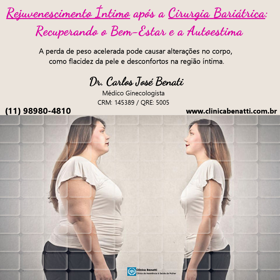 Rejuvenescimento Íntimo após a Cirurgia Bariátrica: Recuperando o bem-estar e a autoestima