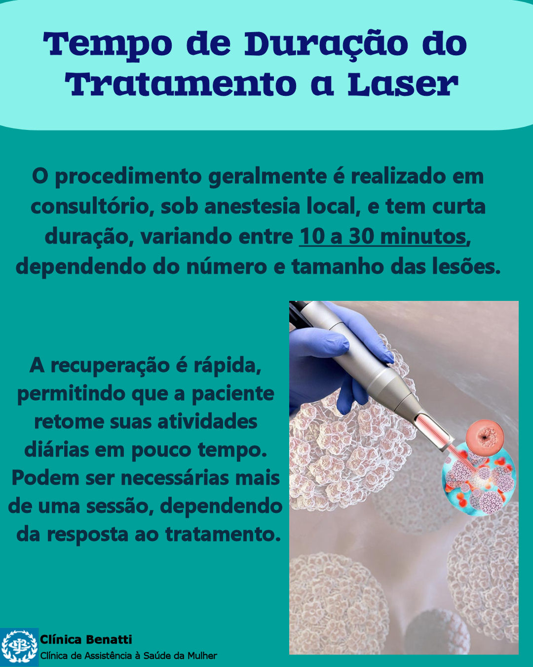 Tempo de Duração do Tratamento a Laser para o HPV Ginecológico